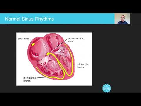 Normal Sinus Rhythms - Australian Paramedical College