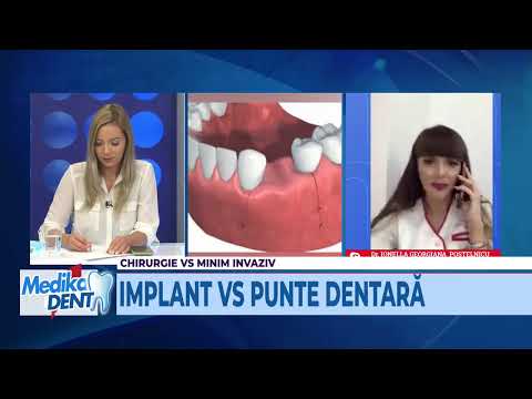 Medika Dent 13.10.2020 – Cât de dificilă este o operaţie pentru implant dentar?