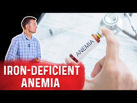 Taking Apple Cider Vinegar For Iron Deficiency Anemia – Dr. Berg