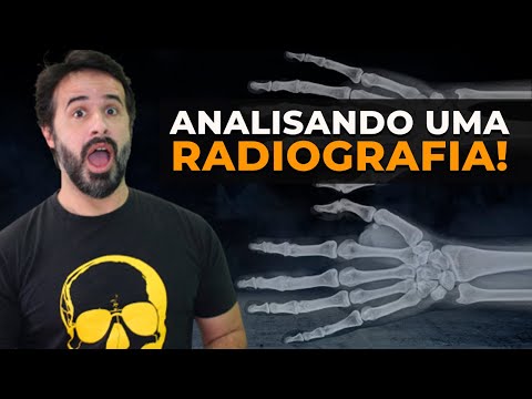 ENTENDA DE UMA VEZ A MANEIRA CORRETA DE SE ANALISAR UMA RADIOGRAFIA!