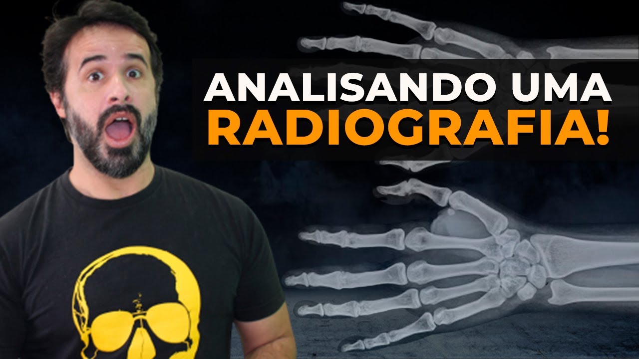 ENTENDA DE UMA VEZ A MANEIRA CORRETA DE SE ANALISAR UMA RADIOGRAFIA!