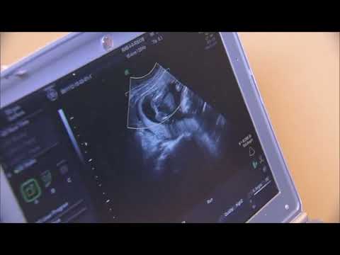 PSS Expectant Mothers