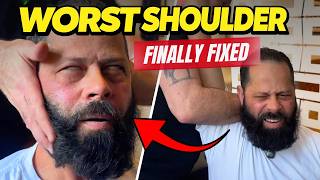 SEVERE SHOULDER PAIN…FINALLY FIXED! 😱
