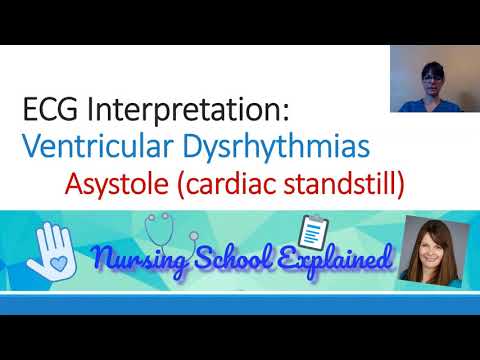 Asystole (aka ventricular standstill)