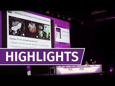 PCR London Valves 2017: relive the highlights of this year's edition!