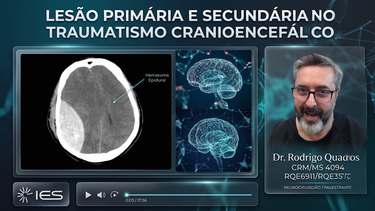 Thumbnail da videoaula — Lesão Cerebral Traumática Primária e Secundária no TCE
