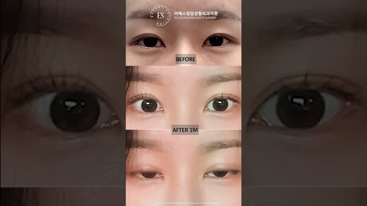 이에스 유튜브