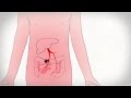 Wie entsteht Krebs | MedUni Wien | Video by VerVieVas