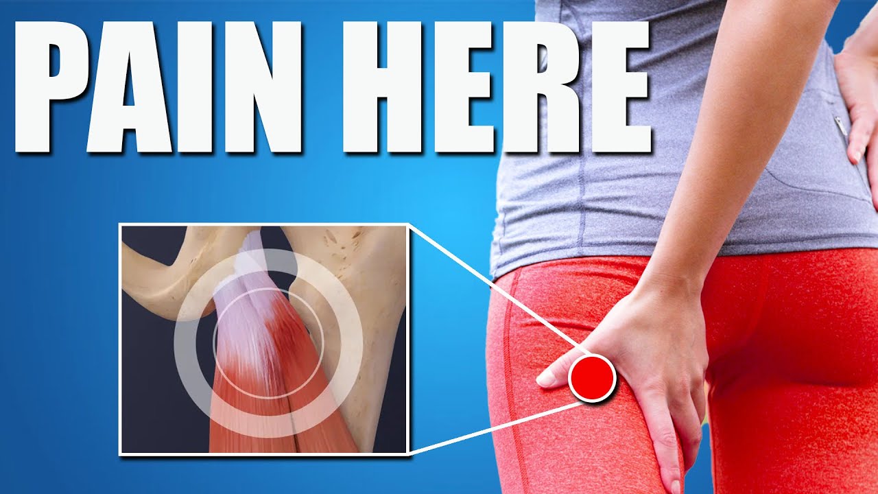 Proximal Hamstring Tendinopathy: Causes, Treatment & Exercises ...