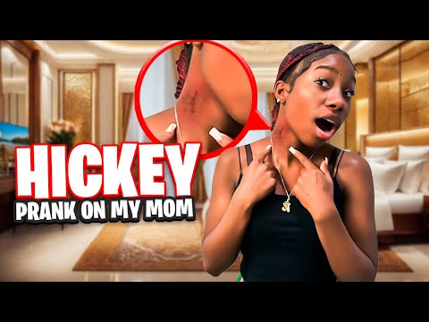 *HICKEY PRANK*