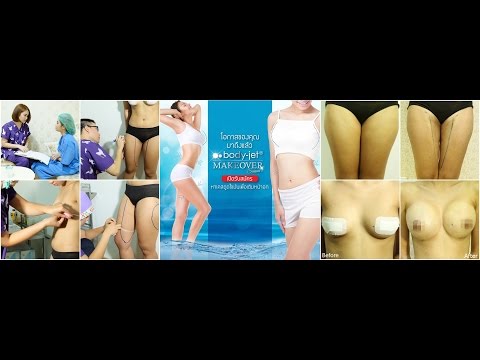 การเสริมเต้านม GRU Push-up bra สำหรับหน้าอกเล็ก