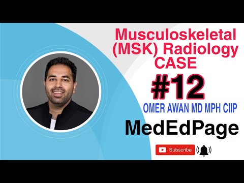 Musculoskeletal (MSK) Radiology CASE #12