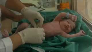 Nascimento do nosso Bebê lindo (parto cesária)