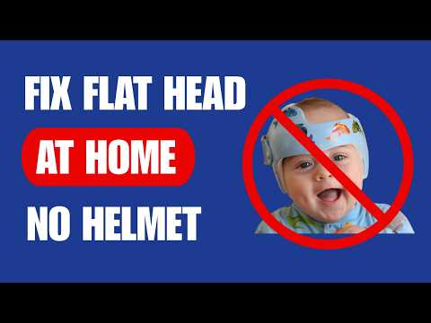 Worried About Baby’s Flat Head? Fix It Naturally Without a Helmet