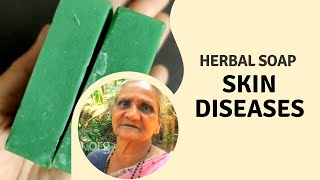Herbal soap for skin diseases