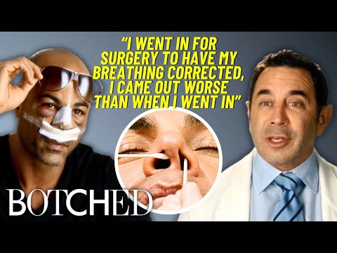 Dr. Nassif Delivers A KNOCKOUT Result For This Former Boxer’s Botched Nose Job | Botched | E!