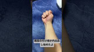 毎日武装色チャレンジ9日目　　　　#現実ONEPIECE