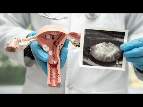 canberra_hero_image_JiMVvYU