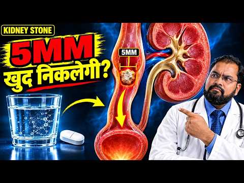Kidney Stone Home Treatment | छोटी पथरी घर पर निकल सकती है?