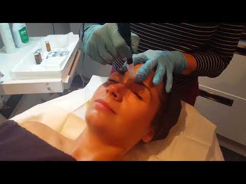 Fractional Mesotherapy and Skin Needling