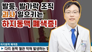 하지동맥폐쇄증