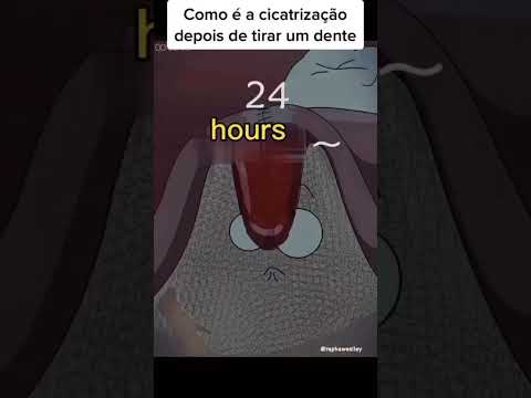 The Healing Process After Tooth Extraction: What to Expect