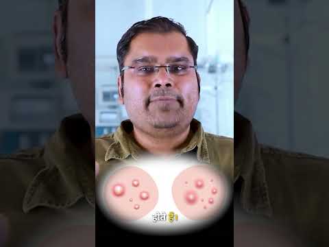 Scrotum Sebaceous Cyst EXPLAINED in 5 Minutes