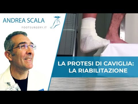 Artrite delle piccole articolazioni del ICD 10 Dolore al polso dopo linfortunio