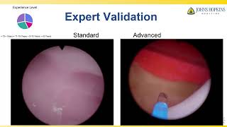 V06-01: Advanced Anatomical Endoscopic Enucleation of the Prostate Simulation Model Development