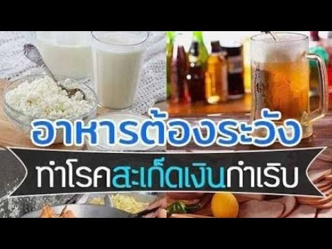ขี้ผึ้งโรคสะเก็ดเงินพื้นบ้าน โรคสะเก็ดเงิน Pyatigorsk โรงพยาบาล