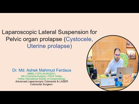 Laparoscopic lateral suspension