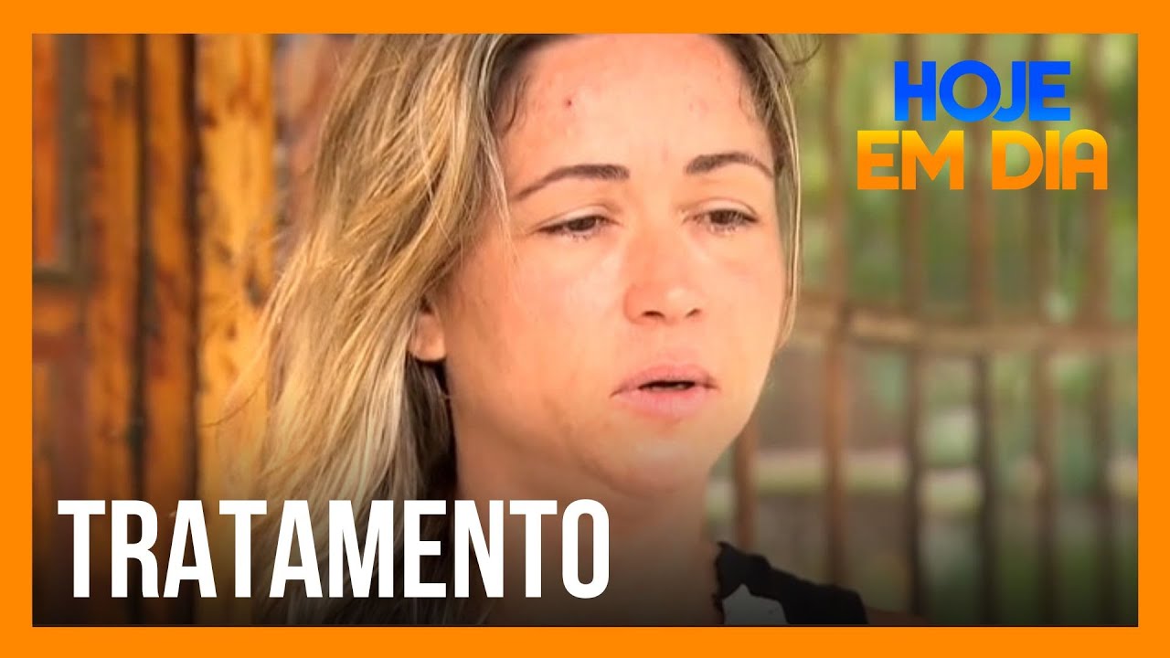 Transtorno deixa sintomas da TPM ainda mais intensos