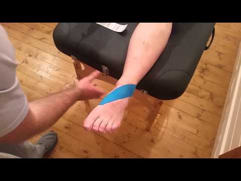 Kinesio Taping for Ankle Instability