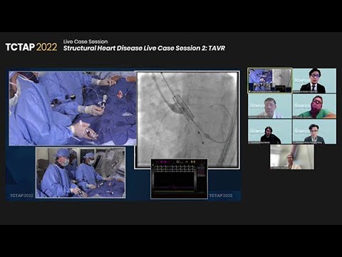 [TCTAP 2022] Structural Heart Disease Live Case Session 2: TAVR