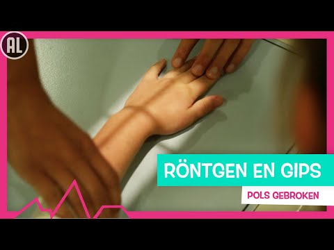 AMBER HEEFT HAAR POLS GEBROKEN - TOPDOKS SEH