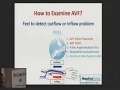 How to Examine AVF in 10 minutes (Arabic verion) - Hands on Real Cases - Dr Mohammed Abdel Gawad