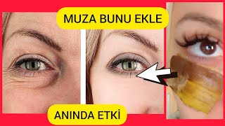 MUZ KABUĞUNA BUNU EKLERSEN GÖZ ÇEVRESİ KIRIŞIKLIK SİLİNİYOR GÖZ ÇEVRESİ AYDINLANIYOR..!