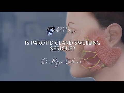 Is parotid gland swelling serious?