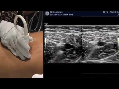 How To Lower Extremity Ultrasound