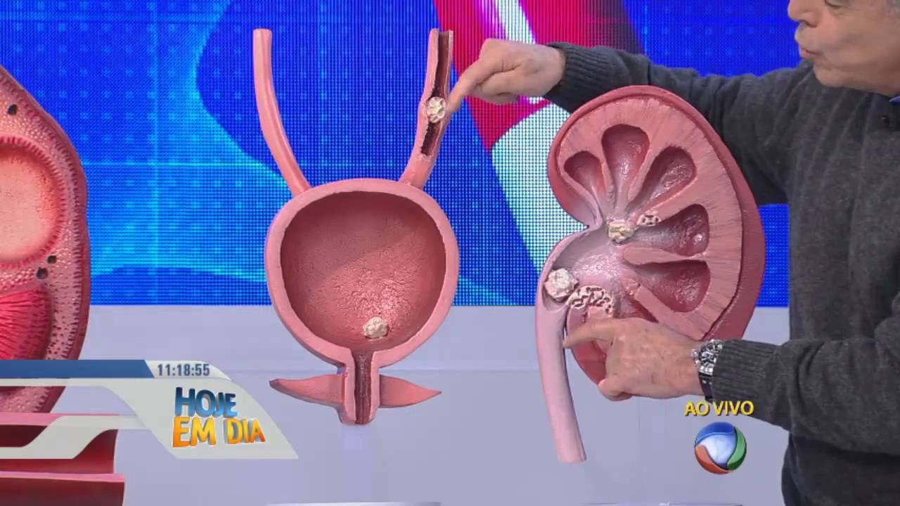Você e o Doutor esclarece as dúvidas sobre os problemas urinários