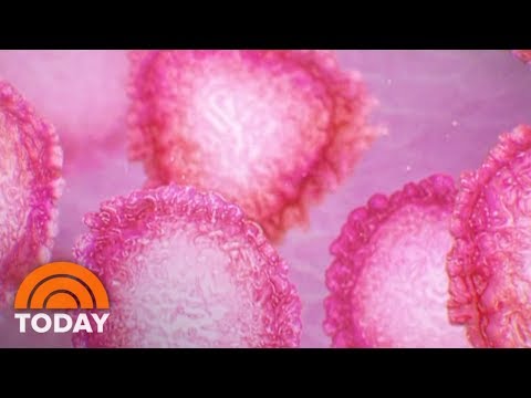 コロナウイルス。米国が公衆衛生上の緊急事態を宣言｜TODAY (Coronavirus: US Declares Public Health Emergency | TODAY)