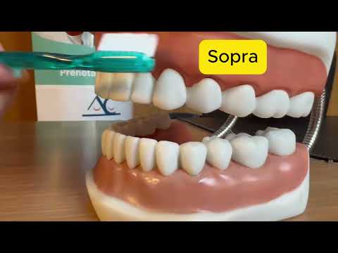 La tecnica corretta per la tua igiene orale con lo spazzolino elettrico