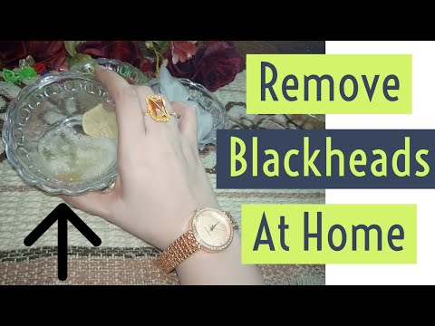 How To Get Rid Of "Blackheads" On Nose & Face Naturally (Remove Blackheads At Home) Video