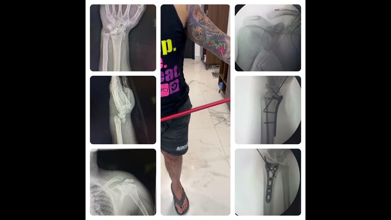 Diego Gomez Orozco-8