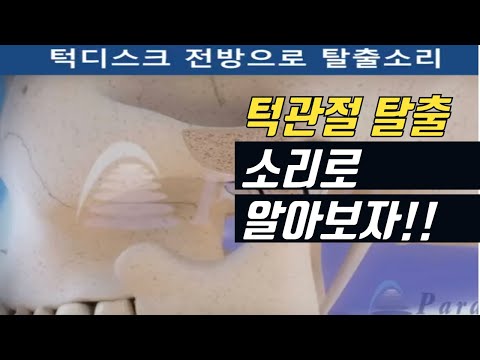 안면비대칭과 턱관절의 관계