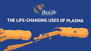 The Life-Changing uses of Plasma