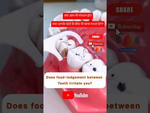 How to remove food from teeth. #teeth #viral #youtubeshorts