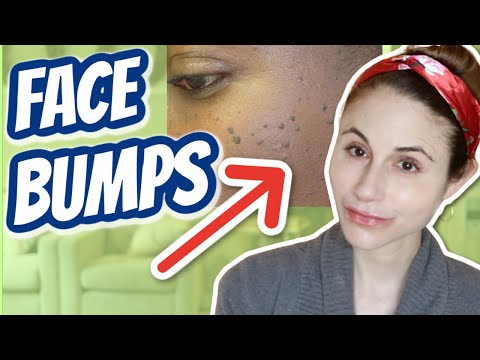 How to get rid of bumps on the face| Dr Dray