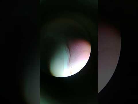 Human Thyroid Gland (Ts) Histology 1