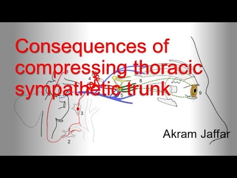 Conséquences de la compression du tronc sympathique